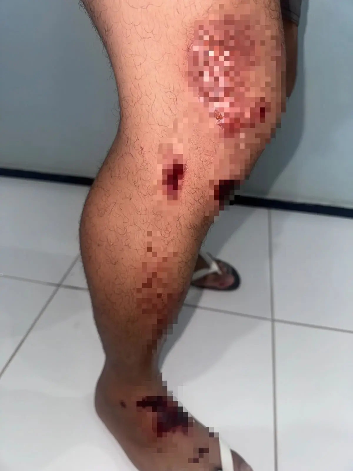 Motocicleta colide contra jumento na saída do Poço Jorrante, em Santa Cruz do Piauí, e duas pessoas ficam feridas