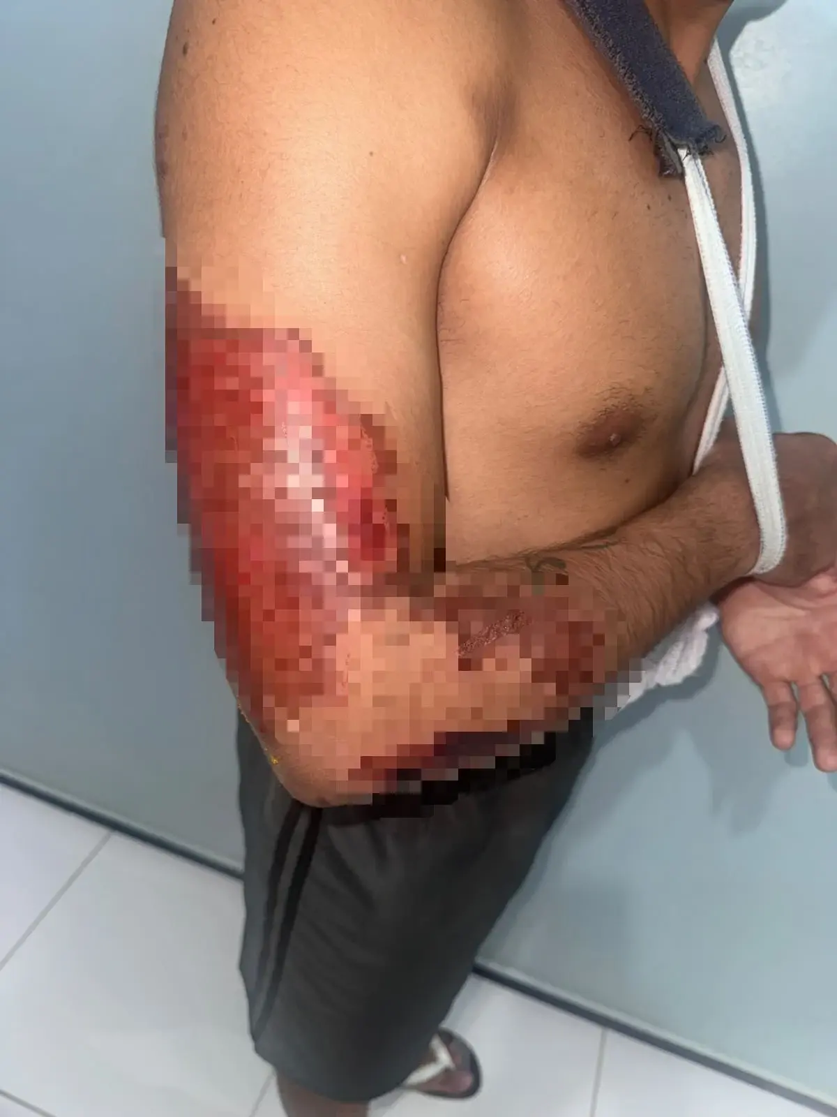 Motocicleta colide contra jumento na saída do Poço Jorrante, em Santa Cruz do Piauí, e duas pessoas ficam feridas